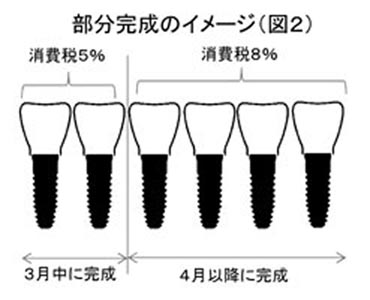 インプラント図２：ヨコ300pix